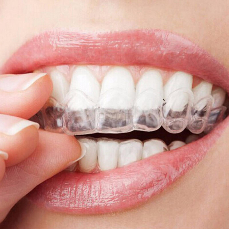 Teeth Whitening With Trays - 1 Buah Nampan Pemutih Gigi Pembentukan