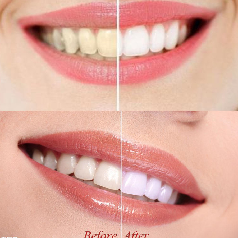 Arang Bambu Gigi Gigi Gigi Gig - Teeth Whitening Quotes ulasan dan harga