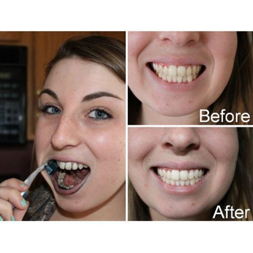 Arang Bambu Gigi Gigi Gigi Gig - Teeth Whitening Quotes ulasan dan harga