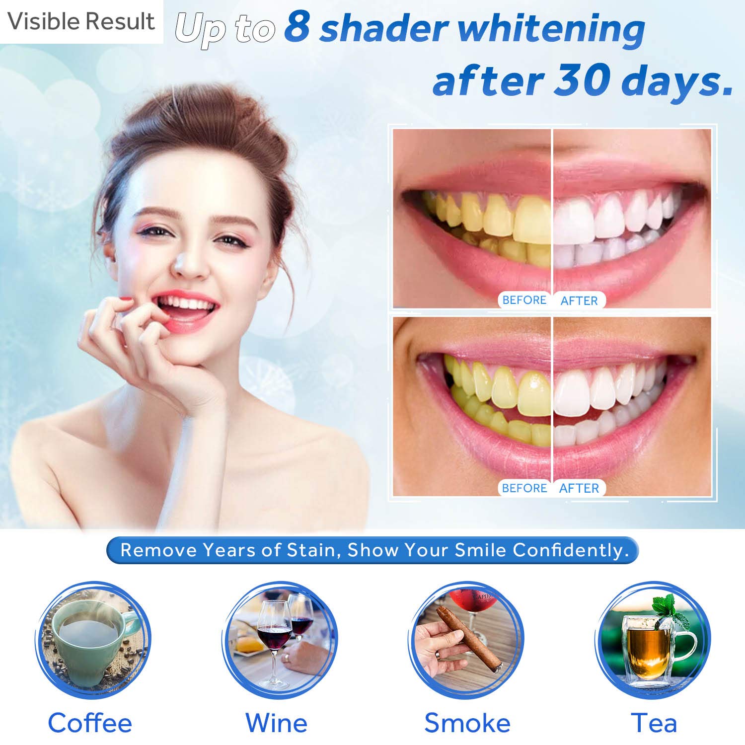 Gel Pemutih Gigi Isi Ulang Syr - Teeth Whitening With Trays ulasan dan harga