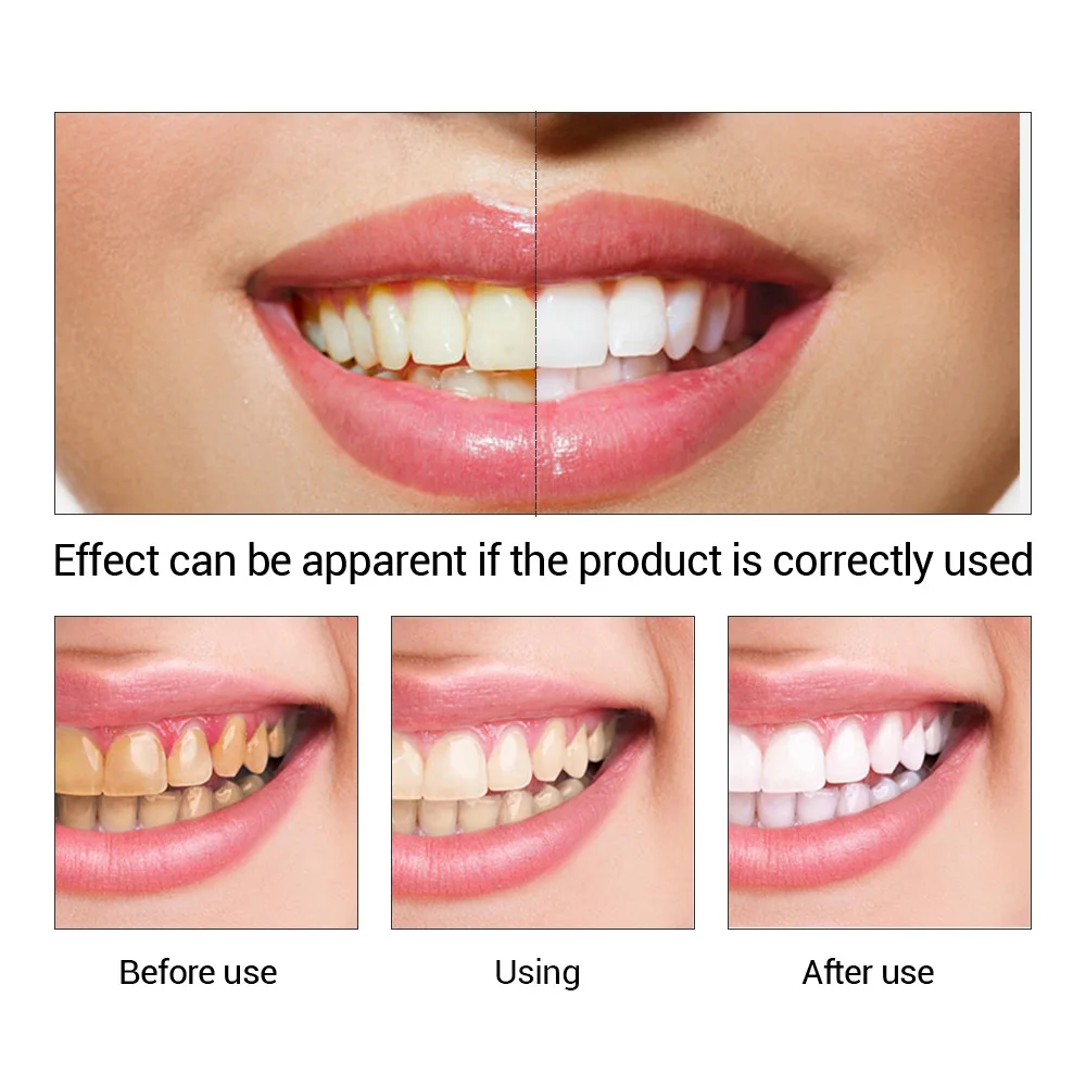 FTEENPLY Bubuk Esensi Pemutih  - Teeth Whitening Quotes ulasan dan harga