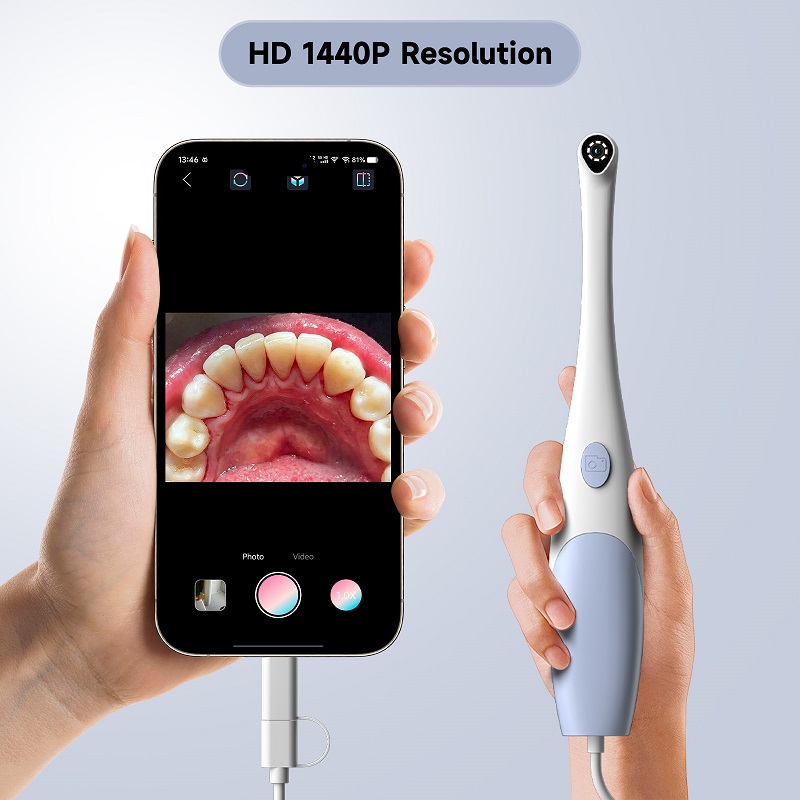 Kamera Endoskop Oral 1440P Fot - Teeth Whitening Video ulasan dan harga