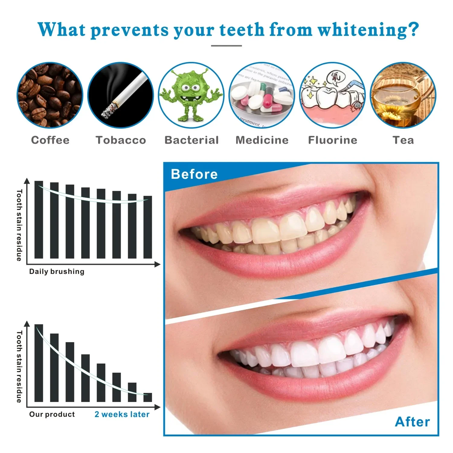14/28 Buah Strip Pemutih Gigi  - Teeth Whitening Effects ulasan dan harga