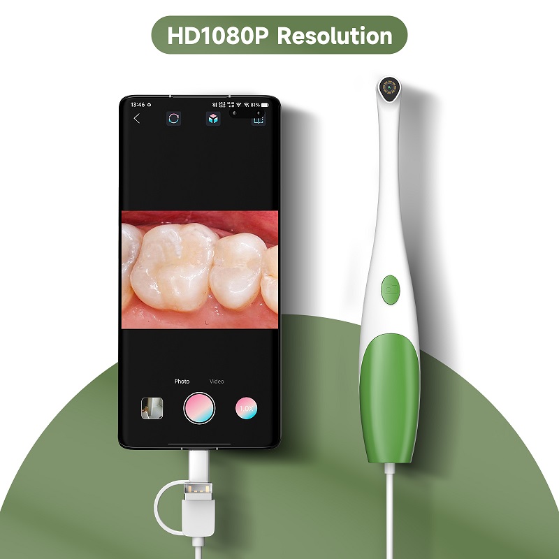 Endoskop Oral TYPE-C Kamera In - Teeth Whitening Video ulasan dan harga