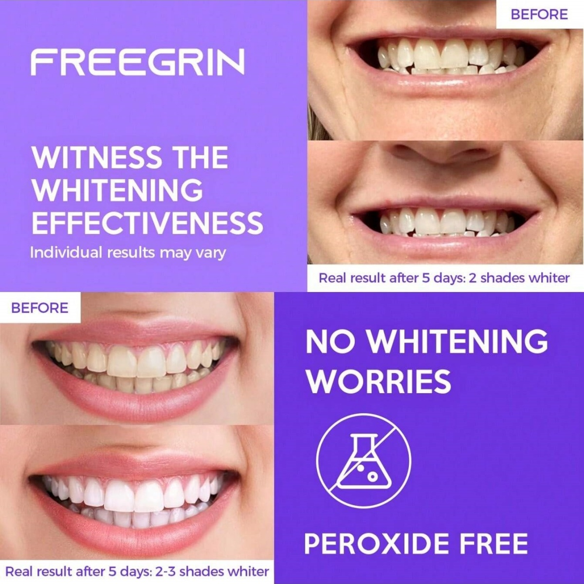 Stiker Gigi Pemutih Mewah 7/14 - Teeth Whitening Quotes ulasan dan harga