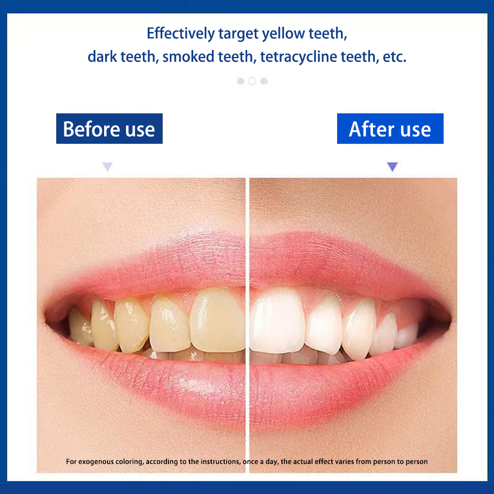 70/140 pasang 5D putih potonga - Teeth Whitening Effects ulasan dan harga